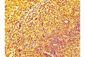 IHC image of ABIN7156602 diluted at 1:100 and staining in paraffin-embedded human tonsil tissue performed on a Leica BondTM system.