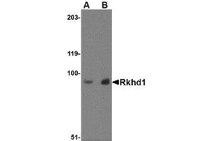 Image no. 1 for anti-Mex-3 Homolog D (MEX3D) (Internal Region) antibody (ABIN341677) (MEX3D anticorps  (Internal Region))