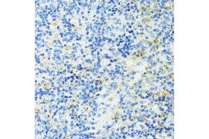 Immunohistochemistry of paraffin-embedded mouse spleen using TIM-3/H antibody (ABIN3016172, ABIN3016173, ABIN3016174, ABIN1680159 and ABIN6219599) at dilution of 1:100 (40x lens). (TIM3 anticorps  (AA 22-202))