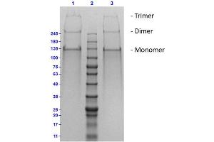 SDS PAGE Results of Human Collagen Type II.