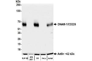 Western Blotting (WB) image for anti-CD226 (CD226) (AA 19-229) antibody (ABIN7455092)