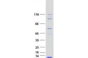 Validation with Western Blot