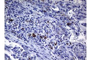 anti-Polymerase (DNA Directed) iota (POLI) (AA 458-740) antibody