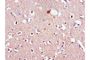 Immunohistochemistry of paraffin-embedded human brain tissue using ABIN7158744 at dilution of 1:100 (LPAR1 anticorps  (AA 316-364))