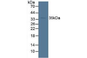 Figure. (SORD anticorps  (AA 98-355))