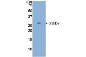 Detection of Recombinant RI, Human using Polyclonal Antibody to Ribonuclease Inhibitor (RI) (RNH1 anticorps  (AA 218-444))