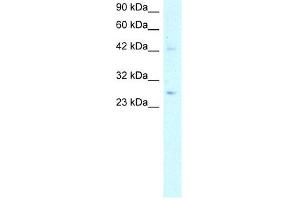 WB Suggested Anti-ACDC Antibody Titration:  5. (ADIPOQ anticorps  (N-Term))