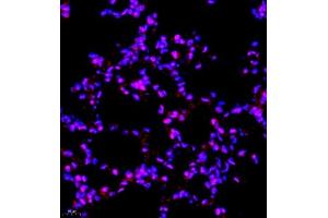 Immunofluorescence of paraffin embedded rat lung using SMNDC1 (ABIN7075773) at dilution of 1:650 (400x lens)