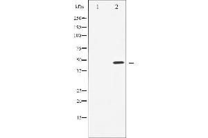 Western blot analysis of Cyclin E1 expression in Paclitaxel treated HeLa whole cell lysates,The lane on the left is treated with the antigen-specific peptide. (Cyclin E1 anticorps  (C-Term))