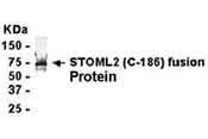Western Blotting (WB) image for anti-Stomatin (EPB72)-Like 2 (STOML2) (AA 171-356) antibody (ABIN2468107) (STOML2 anticorps  (AA 171-356))