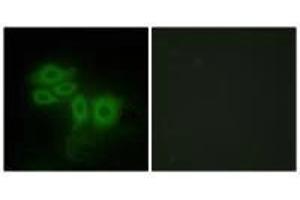Immunofluorescence analysis of HepG2 cells, using SLK antibody. (SLK anticorps  (C-Term))
