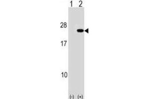 Western Blotting (WB) image for anti-Poly Binding Protein Interacting Protein 2 (PAIP2) antibody (ABIN2998979) (PAIP2 anticorps)