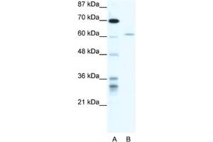 Western Blotting (WB) image for anti-IKAROS Family Zinc Finger 4 (Eos) (IKZF4) antibody (ABIN2460680) (IKZF4 anticorps)