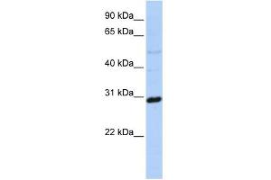 WB Suggested Anti-MTX2 Antibody Titration: 0. (MTX2 anticorps  (N-Term))
