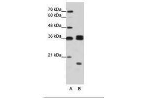 Image no. 2 for anti-Heterogeneous Nuclear Ribonucleoprotein H3 (2H9) (HNRNPH3) (AA 51-100) antibody (ABIN203064) (HNRNPH3 anticorps  (AA 51-100))
