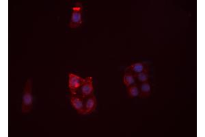 ABIN6266475 staining HUVEC  cells by IF/ICC.