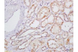 Formalin-fixed and paraffin embedded human kidney labeled with Rabbit Anti-IL-31 Polyclonal Antibody, Unconjugated  at 1:200 followed by conjugation to the secondary antibody and DAB staining (IL-31 anticorps  (AA 31-130))