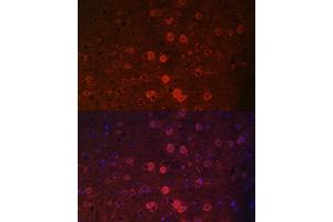 Immunofluorescence analysis of mouse brain using TRPM2 antibody (ABIN6128836, ABIN6149582, ABIN6149583 and ABIN6221738) at dilution of 1:100.
