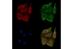 ABIN6258067 and ABIN6274651 staining Hela cells by IF/ICC.