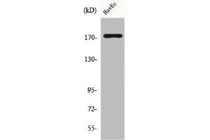 Western Blot analysis of HuvEc cells using COL11A2 Polyclonal Antibody