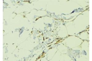 ABIN6276479 at 1/100 staining Human lung tissue by IHC-P.