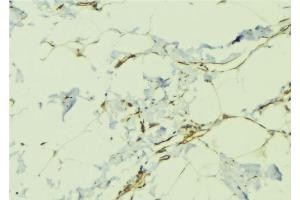 ABIN6276479 at 1/100 staining Human lung tissue by IHC-P.