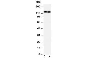 Western blot testing of N-Cadherin antibody and Lane 1:  MCF-7 (N-Cadherin anticorps  (AA 701-714))