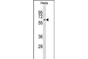 KLHL12 Antibody (C-term) (ABIN1537222 and ABIN2848955) western blot analysis in Hela cell line lysates (35 μg/lane). (KLHL12 anticorps  (C-Term))