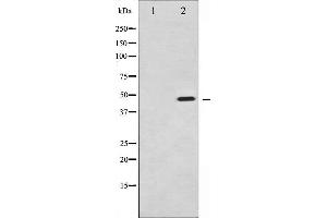 Western blot analysis of Synaptotagmin phosphorylation expression in Sobital treated 293 whole cell lysates,The lane on the left is treated with the antigen-specific peptide.