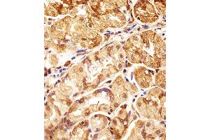 anti-Polymerase (DNA-Directed), delta Interacting Protein 3 (POLDIP3) (AA 93-120), (N-Term) antibody