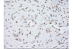 Image no. 1 for anti-Glial Fibrillary Acidic Protein (GFAP) antibody (ABIN1498440) (GFAP anticorps)