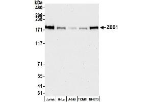 Western Blotting (WB) image for anti-Zinc Finger E-Box Binding Homeobox 1 (ZEB1) (AA 1074-1124) antibody (ABIN7454797)