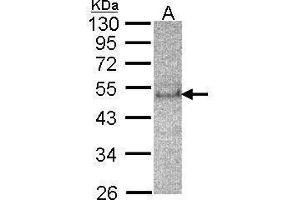 WB Image Sample(30 μg of whole cell lysate) A:HeLa S3, 12% SDS PAGE antibody diluted at 1:200 (SOCS4 anticorps  (C-Term))