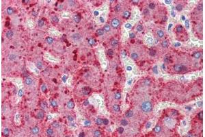 Human Liver (formalin-fixed, paraffin-embedded) stained with ALPL antibody ABIN462352 followed by biotinylated anti-mouse IgG secondary antibody ABIN481714, alkaline phosphatase-streptavidin and chromogen.