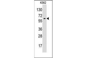 Western blot analysis of anti-GPC6 Pab in K562 cell line lysates (35ug/lane). (Glypican 6 anticorps  (N-Term))