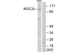 Western Blotting (WB) image for anti-Nucleolar Complex Associated 3 Homolog (NOC3L) (Internal Region) antibody (ABIN6300703) (NOC3L anticorps  (Internal Region))