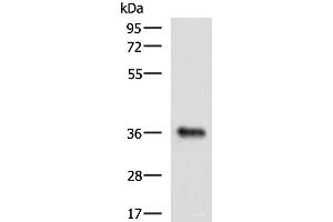 Western blot analysis of Mouse liver tissue lysate using GRHPR Polyclonal Antibody at dilution of 1:900 (GRHPR anticorps)