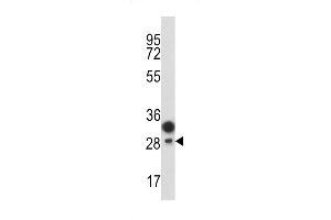 Western blot analysis of C antibody (Center) (ABIN389416 and ABIN2839501) in T47D cell line lysates (35 μg/lane). (PROCR anticorps  (AA 104-132))