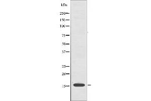 Western blot analysis of extracts from A549 cells, using CYB5 antibody. (CYB5A anticorps  (Internal Region))