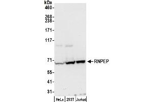 anti-Arginyl Aminopeptidase (Aminopeptidase B) (RNPEP) (AA 600-650) antibody