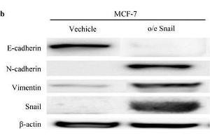 Expression of epithelial-mesenchymal transition (EMT) markers in MCF-7 o/e Snail cells. (Vimentin anticorps)