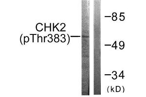 Western Blotting (WB) image for anti-Checkpoint Kinase 2 (CHEK2) (pThr383) antibody (ABIN1847337) (CHEK2 anticorps  (pThr383))