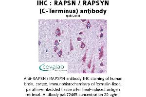 Image no. 1 for anti-Receptor-Associated Protein of The Synapse (RAPSN) antibody (ABIN1738731) (RAPSN anticorps)