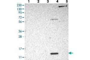 Western blot analysis of Lane 1: RT-4, Lane 2: U-251 MG, Lane 3: Human Plasma, Lane 4: Liver, Lane 5: Tonsil with PSMG3 polyclonal antibody . (PSMG3 anticorps)