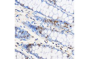 Immunohistochemistry of paraffin-embedded Human colon using ZNF263 Rabbit pAb (ABIN7271472) at dilution of 1:100 (40x lens).