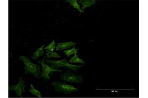 Immunofluorescence of monoclonal antibody to STAT4 on HeLa cell. (STAT4 anticorps  (AA 1-748))