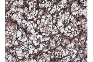 Image no. 7 for anti-Ubiquitin Specific Peptidase 9, X-Linked (USP9X) (AA 2246-2570) antibody (ABIN1491228) (USP9X anticorps  (AA 2246-2570))