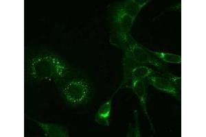 Immunofluorescence (IF) image for anti-MHV NSP9 antibody (ABIN400814) (MHV NSP9 anticorps)