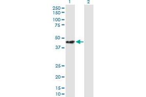 Western Blot analysis of STOML2 expression in transfected 293T cell line by STOML2 MaxPab polyclonal antibody.