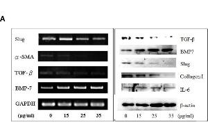 Butylidenephthalide reduces EMT-related gene expression in dosage dependent manner in vivo and in cultured HSCs.